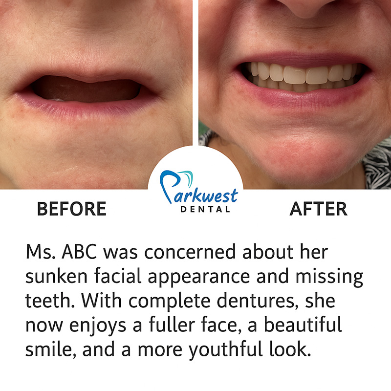 Park West Dental | Periodontal Treatment, Crowns and Inlays  amp  Onlays