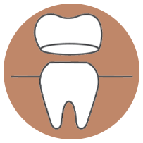 Alt text   Illustration of a tooth with a cross-section view showing its internal structure.